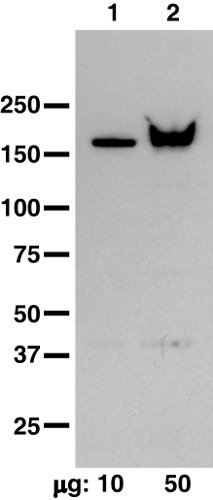 western blot using anti-clathrin heavy chain antibody on Chlamydomonas samples